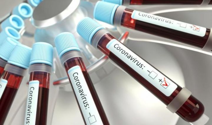Azərbaycanda koronavirus ilə bağlı son vəziyyət açıqlandı