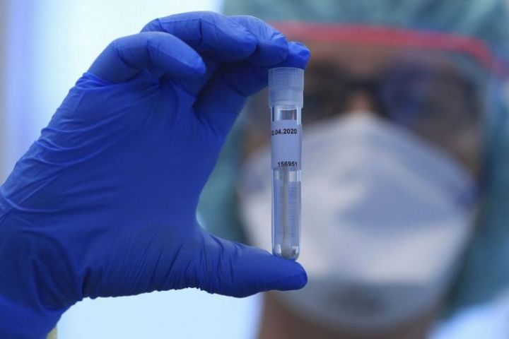 Azərbaycanda koronavirus ilə bağlı son vəziyyət