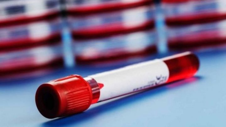 Azərbaycanda koronavirus ilə bağlı son vəziyyət açıqlandı