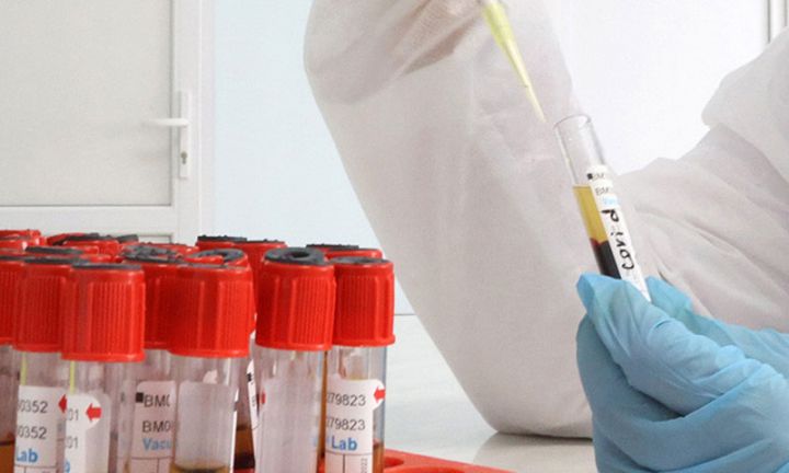 Azərbaycanda koronavirus ilə bağlı son vəziyyət açıqlandı