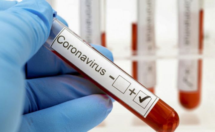 Azərbaycanda son bir həftədə koronavirus ilə bağlı vəziyyət açıqlandı