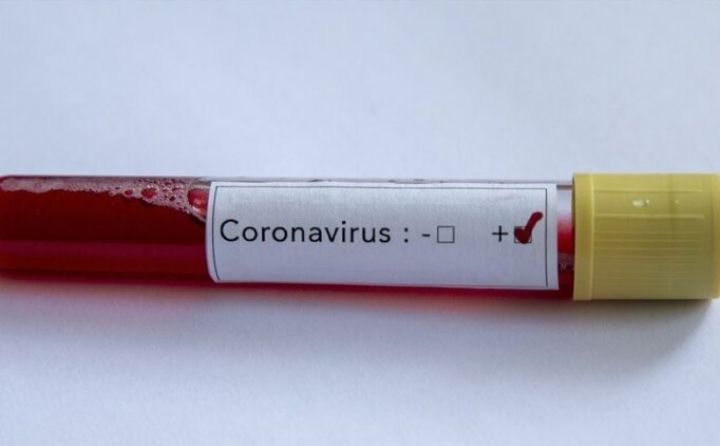 Azərbaycanda koronavirusa yoluxanlar daha da artdı - SON VƏZİYYƏT